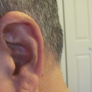 home remedies for ear infection